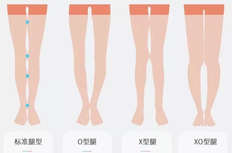 腿型不好怎么穿搭图片,腿型不好怎么穿搭