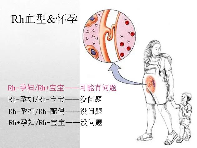 rh血型是真的熊猫血么,o型rh熊猫血