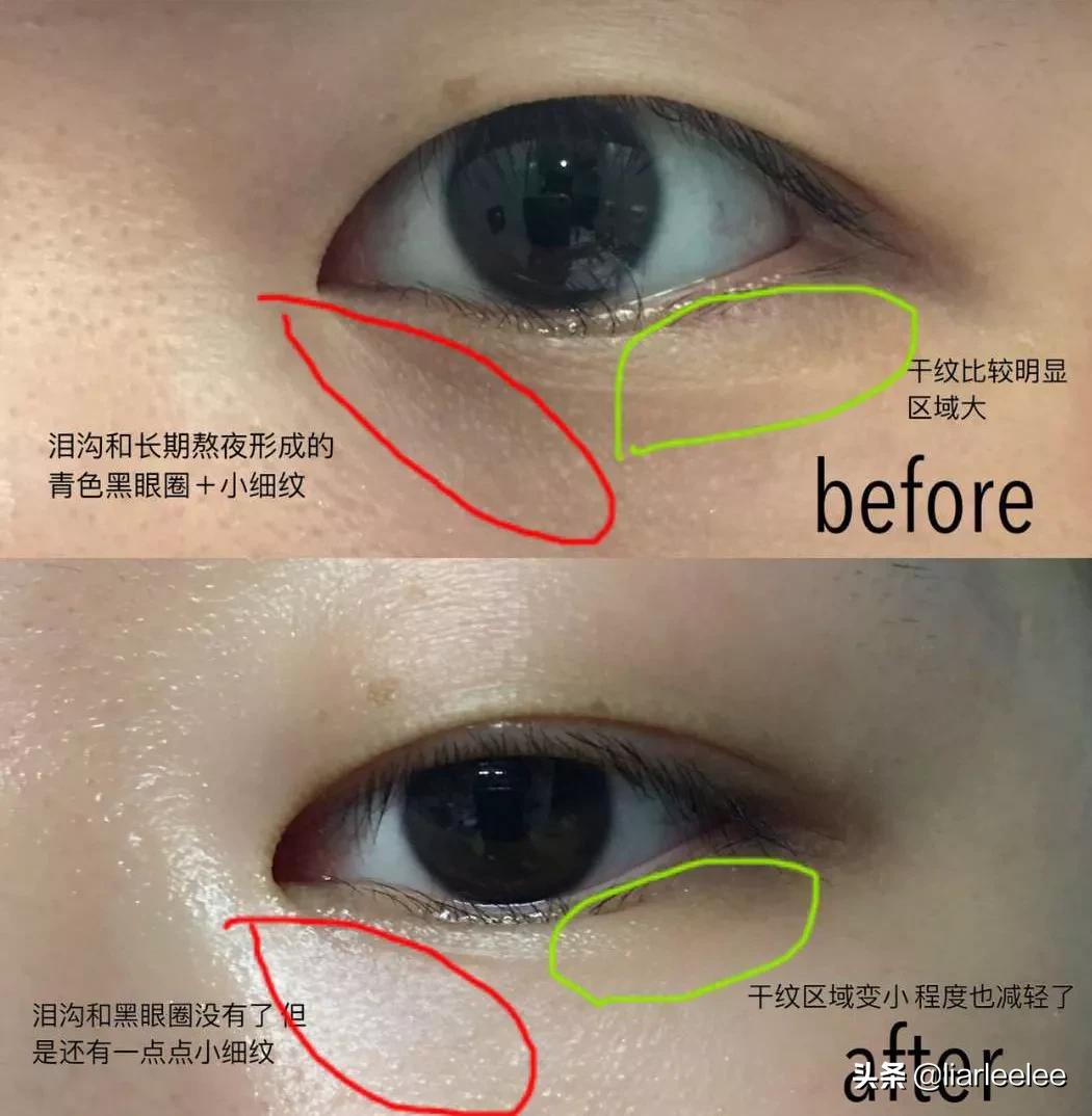 去细纹哪款眼霜值得入手百元内,又方便又好用的一款眼霜