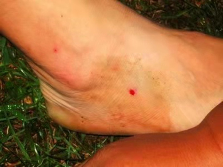 我和虫子大战完整版,我与昆虫的对决