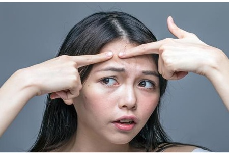 为什么额头痘痘比脸上痘痘容易好,额头长痘的原因及治疗青春痘方法