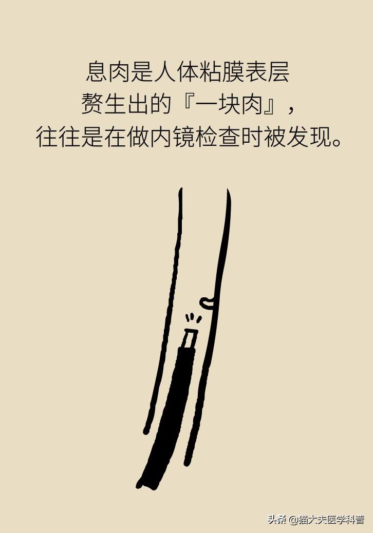 结节囊肿息肉的区别,结节增生囊肿息肉哪种癌前病变