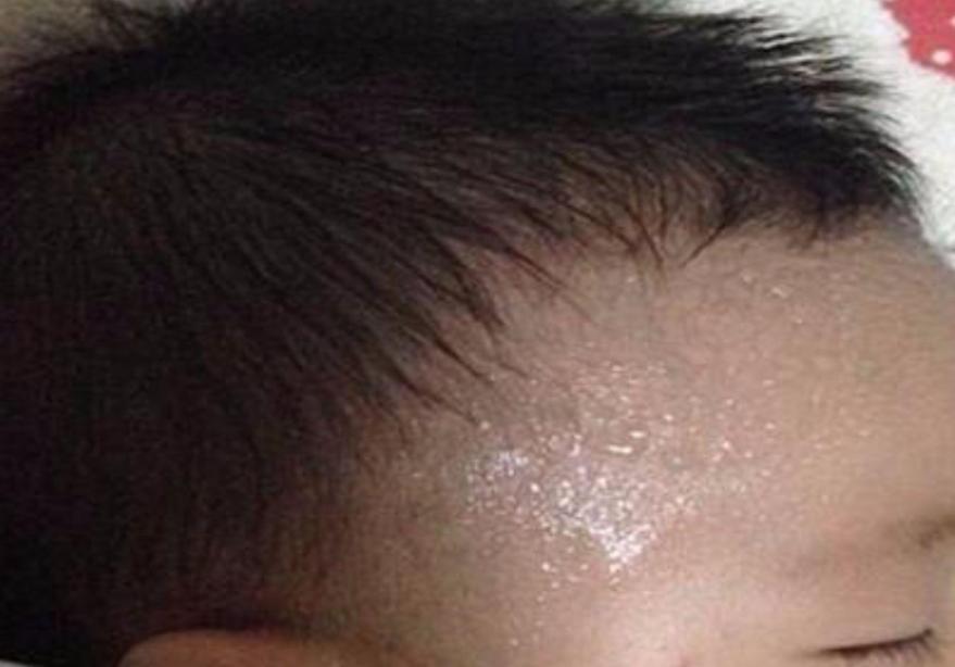 孩子睡觉容易出汗原来是这么回事,10个月宝宝半夜睡觉出汗是缺钙吗