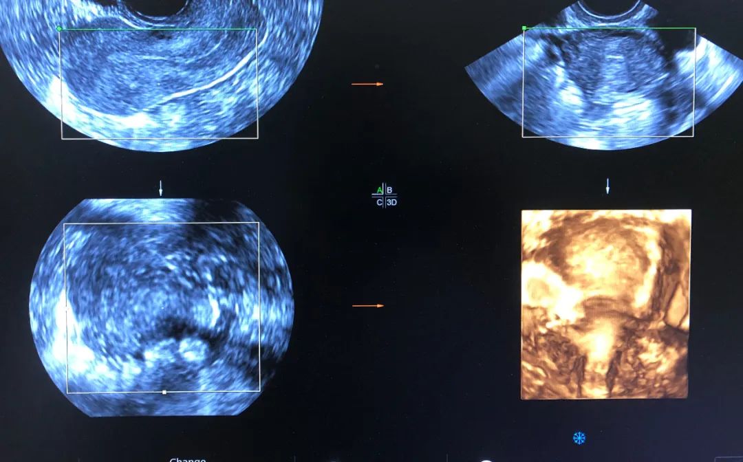 渭南妇幼四维彩超电话,渭南市妇幼保健院四维单子
