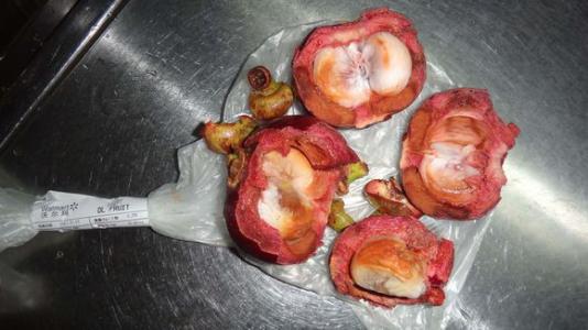 山竹里面有黄浆是什么原因,山竹剥开果肉发粘是坏了吗