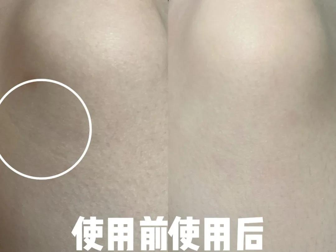 有没有搞错，这样的天仙也有人喷？