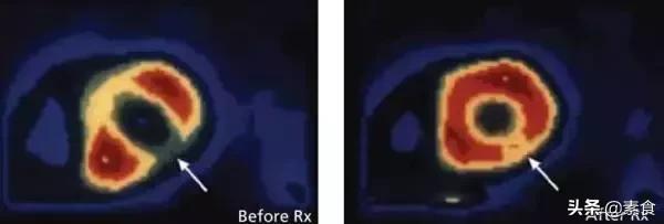 让这对貌美如花的双胞胎告诉您——成为素食者真的好吗？