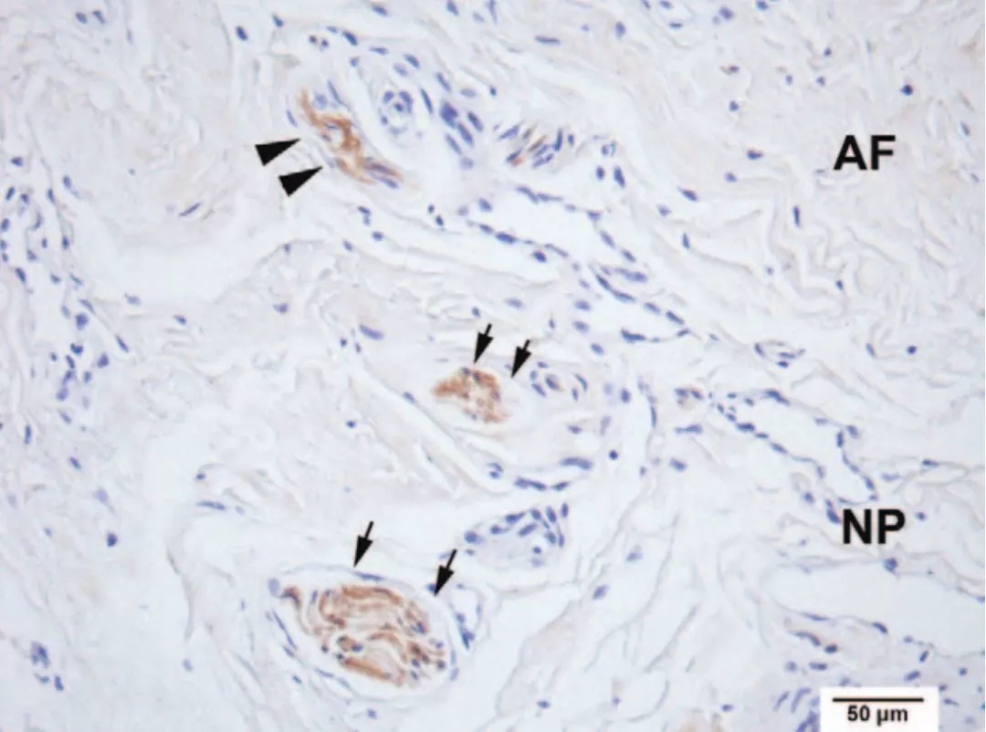 颈椎病眩晕已能够根治！中国专家发现新机制，攻克医学难题！