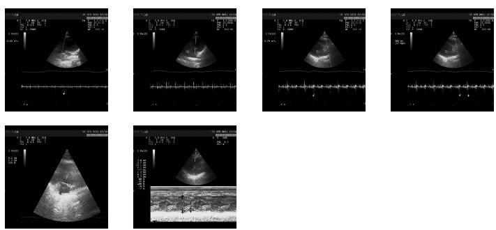“喵“生绝育大事，腹腔镜下“微”察秋毫，让疼痛降到更低