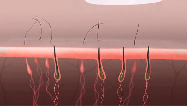 “闺蜜看见我脱毛，说我心机太重”