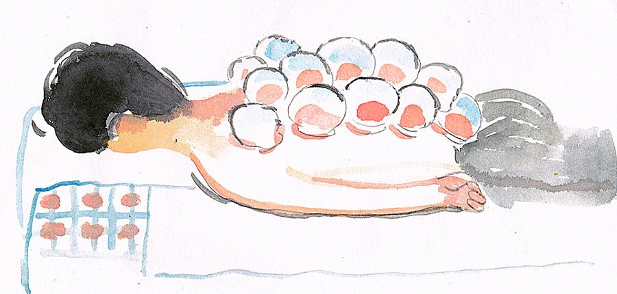 拔罐的知识与视频解说,拔罐后的罐印代表什么你知道吗