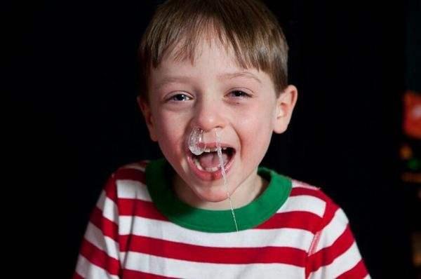 宝宝感冒不停的流鼻涕怎么缓解,宝宝感冒流鼻涕可以自愈吗