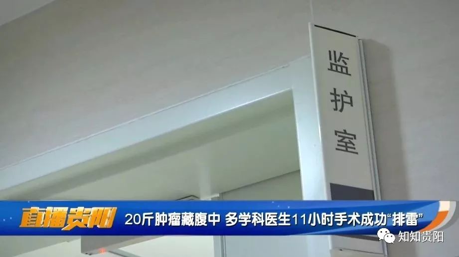 腹部巨大肿瘤医生说只能活3天,腹腔30斤肿瘤