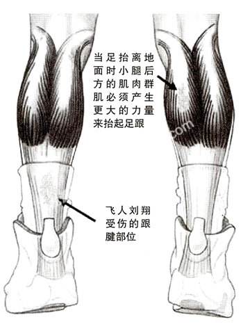 跟腱炎如何预防,跑步的危险