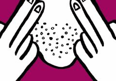 毛孔粗大的原因及改善方法,毛孔粗大的原因和治疗方法