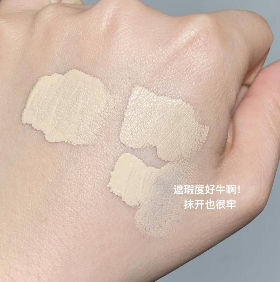 严重泪沟黑眼圈,淡化黑眼圈和泪沟原理