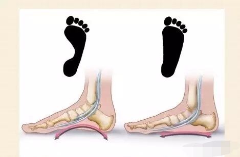 如何练好脚趾瑜伽,练习脚根基的瑜伽动作