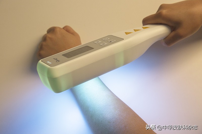 nb-uvb光疗仪使用方法,nbuvb紫外线光疗仪作用