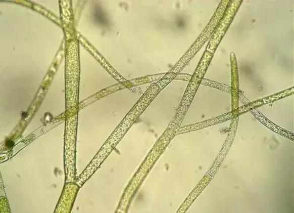 水产养殖藻类老化是怎样的,水产养殖显微镜下各种藻类