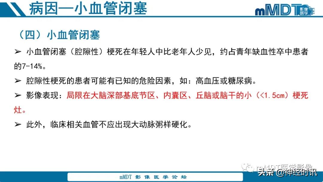 缺血性脑卒中护理课件,缺血性脑卒中讲课ppt