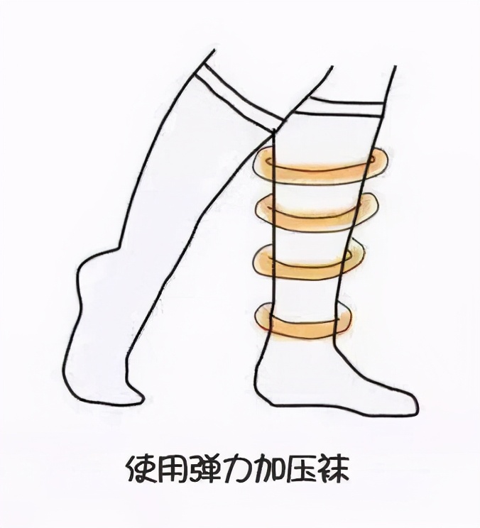压缩袜的作用,穿压缩袜好处
