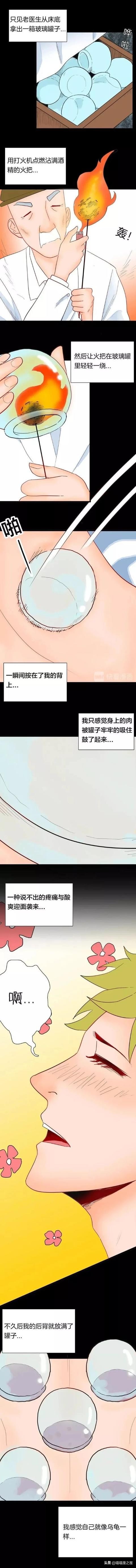 拔火罐祛湿跟祛湿茶哪个效果好,脾虚湿气重能喝薏仁祛湿茶吗