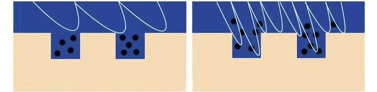 祛背部痘印的日常方法,用什么可以祛后背痘印