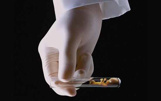 输卵管造影vs输卵管通液