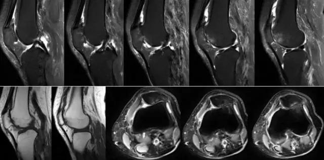 mri临床医师必读电子书,临床医生如何读mri