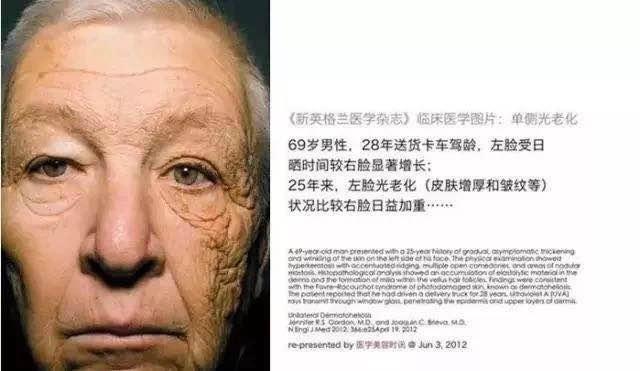 防晒 +|后来遇见它，陪我春秋冬夏