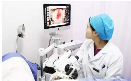 你们医生讲话这么复杂，宫颈癌筛查CIN1级到底要不要治？