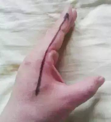 咳嗽牙疼口疮恶寒,咳嗽头疼牙疼鼻塞