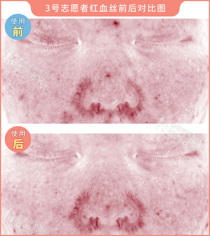 测评家用美容仪真的有用吗,网红推荐的美容仪有用吗