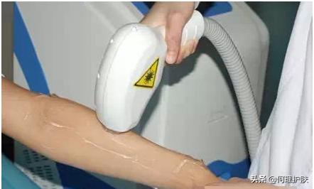 激光脱毛能永久吗腋下,激光脱毛能永久吗知乎