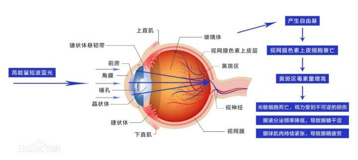 网购眼镜质量怎么选,网购眼镜避坑