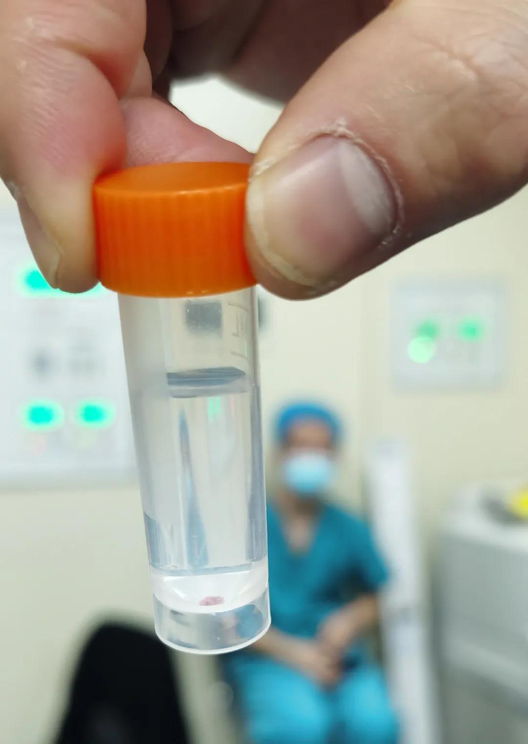 太原一家医院完成山西首例心肌活检！导管下取出“心头肉”