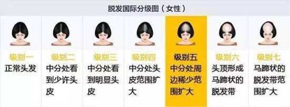 秃头大叔如何治疗脱发,30岁男人脱发严重怎么解决