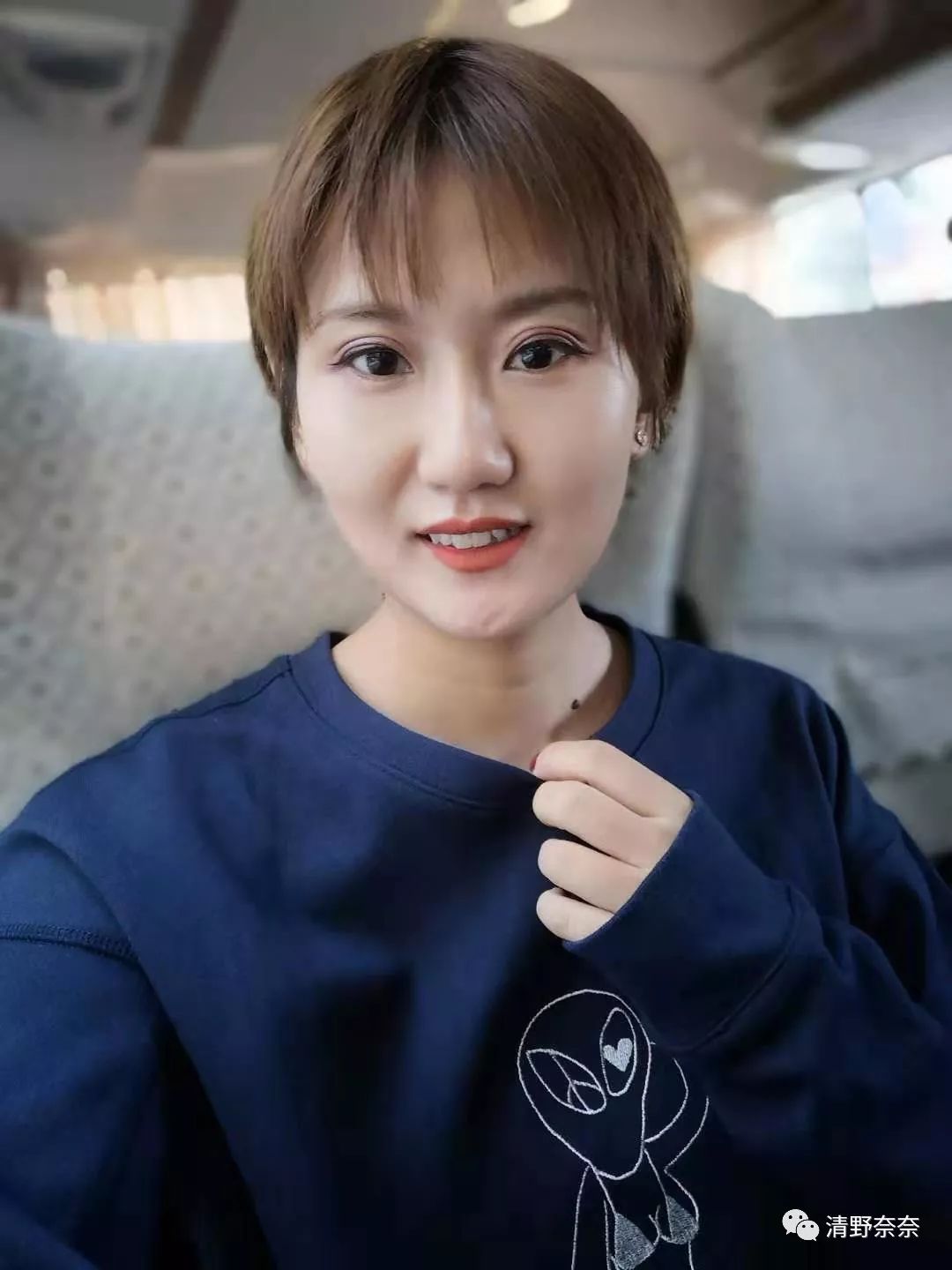 改善法令纹和川字纹抬头纹医美,祛除法令纹鱼尾纹最佳医美方法