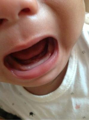 宝宝体重减轻了但不发烧,宝宝体重增加不明显