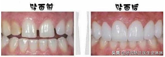 淄博诺尔曼齿科种牙怎么样,淄博诺尔曼齿科整牙费用