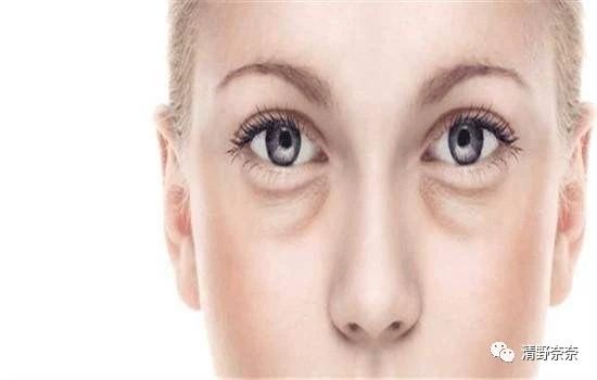 黑眼圈和眼袋可以通过眼霜消除吗,用什么样的眼霜能去除眼袋黑眼圈