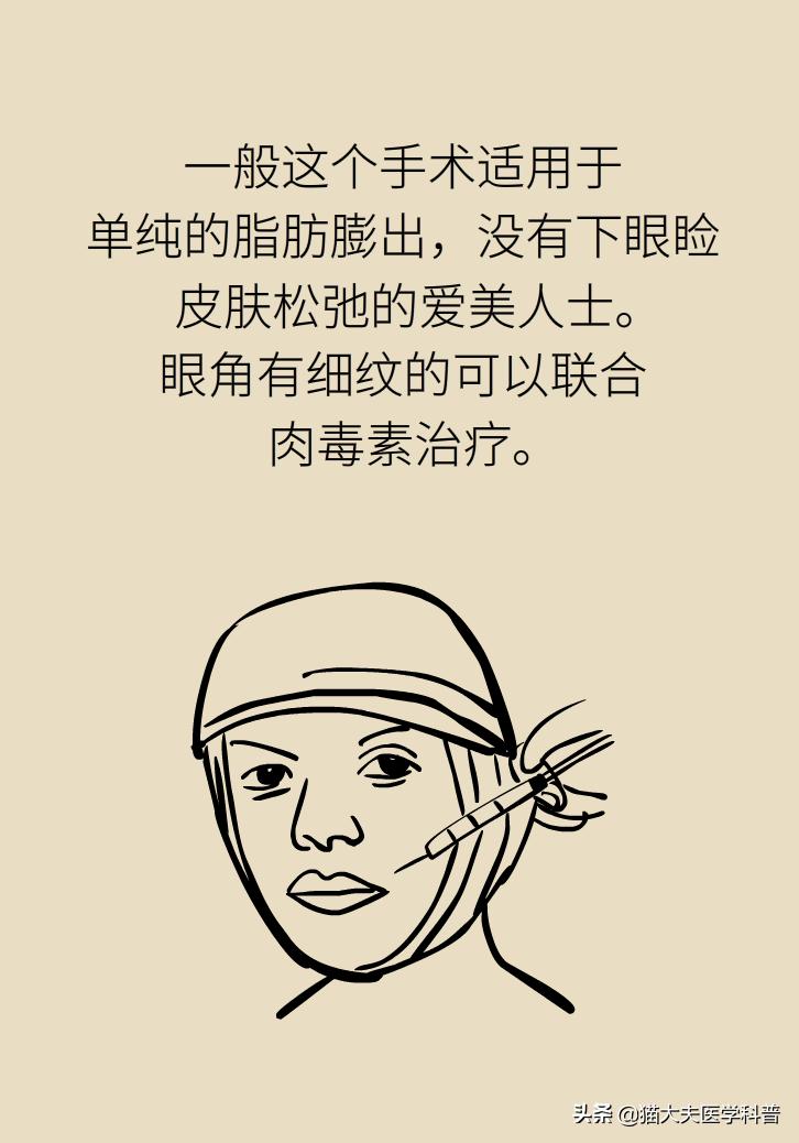 有眼袋怎么办五种去眼袋秘方,眼袋重最简单的去眼袋的方法