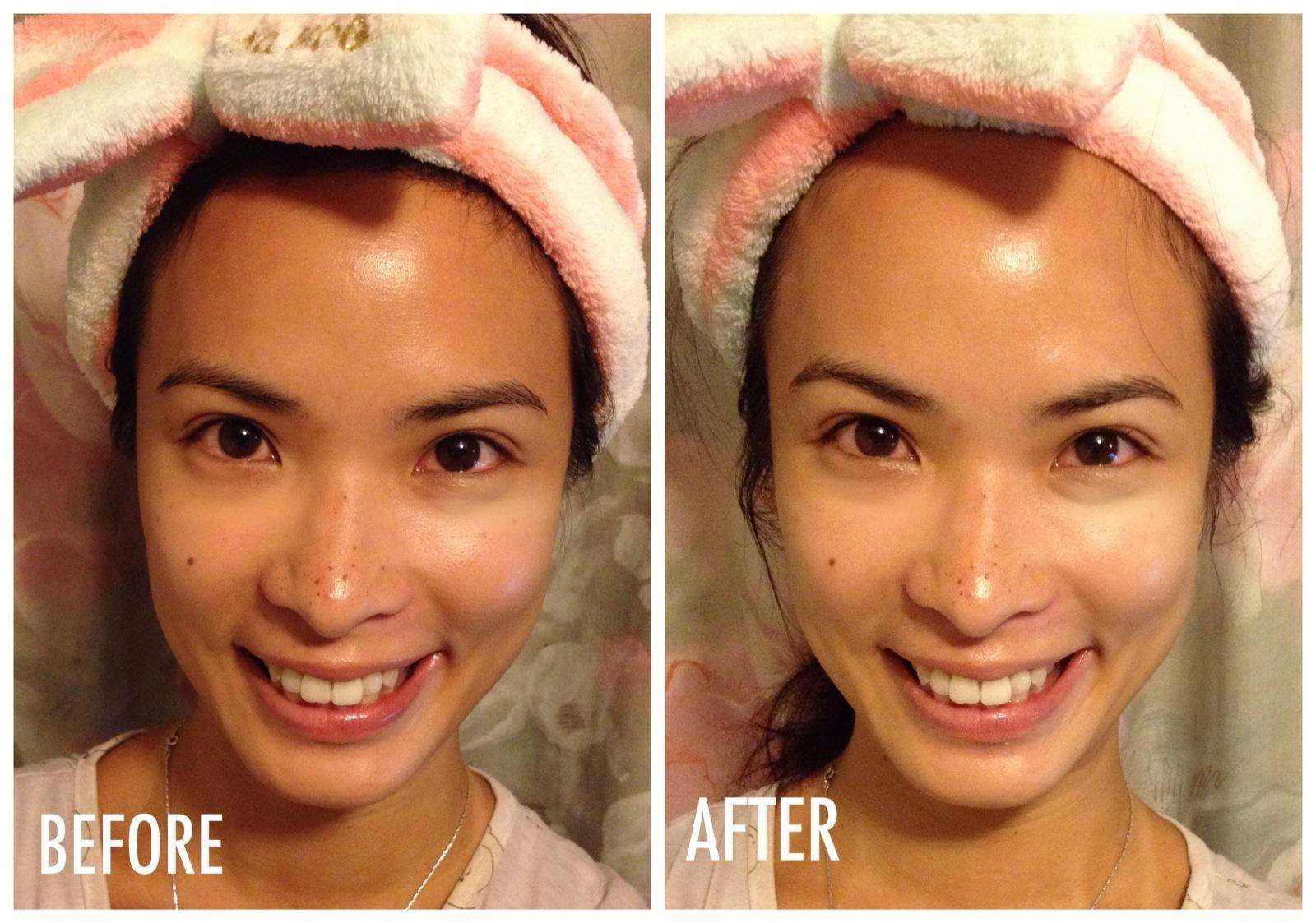 蜂蜜和开塞露一起能淡斑吗,开塞露加蜂蜜美白淡斑的正确方法