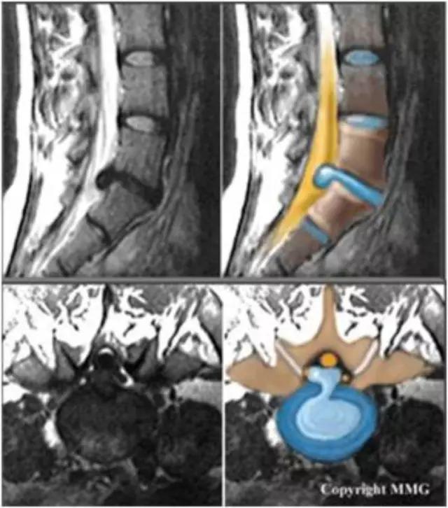 mri临床医师必读电子书,临床医生如何读mri