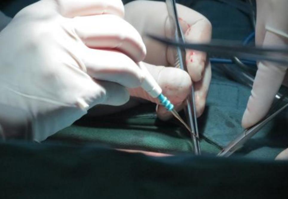 生完孩子想上大号怎么办,马上生宝宝了在医院要注意什么