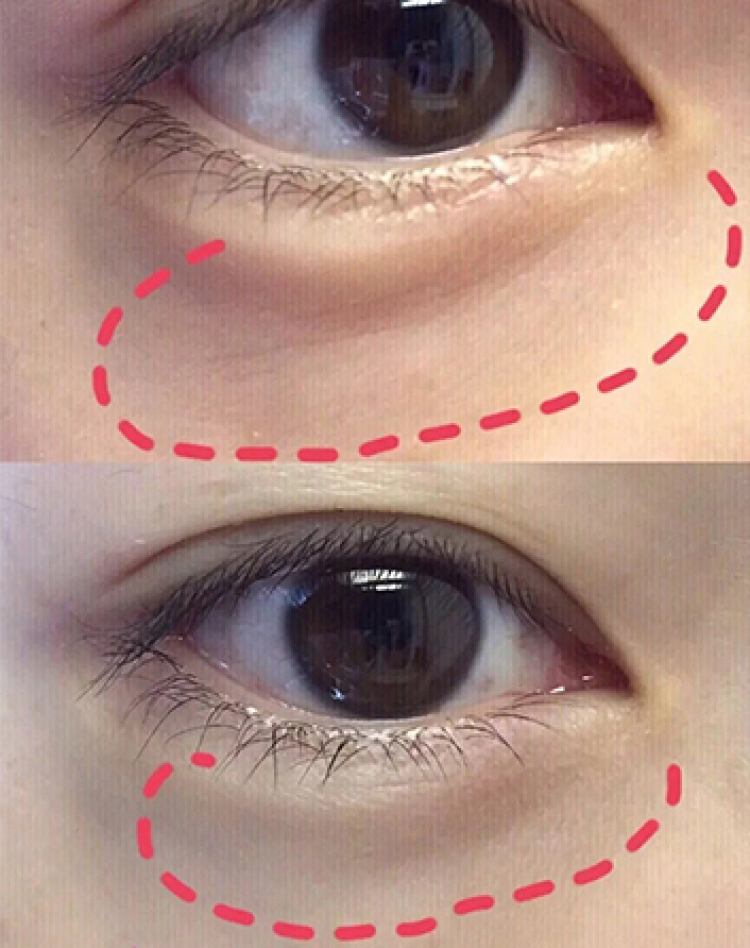 修复眼部细纹的眼膜,秋冬眼睛下长细纹用什么眼膜好