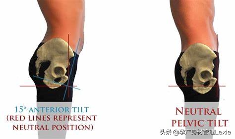 孕期为什么会出现腰痛、下背痛？真相在这里