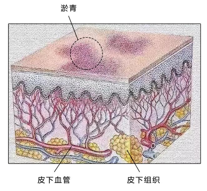 女孩子洗澡水烫和融化原因,女孩子洗澡水真的很烫吗