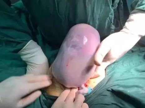 妈妈生下四胞胎爸爸急哭了,妈妈生下双胞胎儿子爸爸绝望