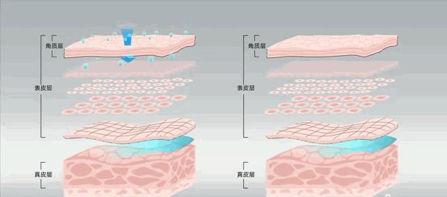 硬刚女皇龙妈也扛不住法令纹，2条沟壑让人心疼，贴一贴就消了